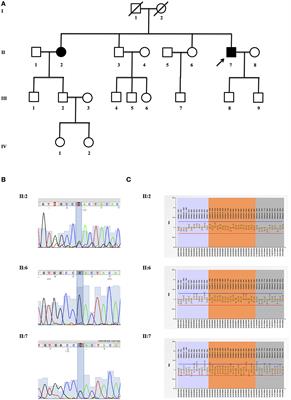 Heterozygous PLA2G6 Mutation Leads to Iron Accumulation Within Basal Ganglia and Parkinson's Disease